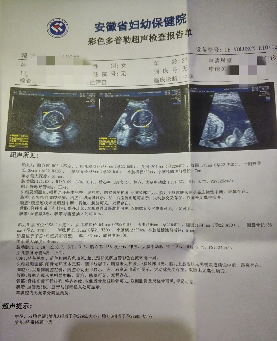 22周胎儿性别清晰大图图片