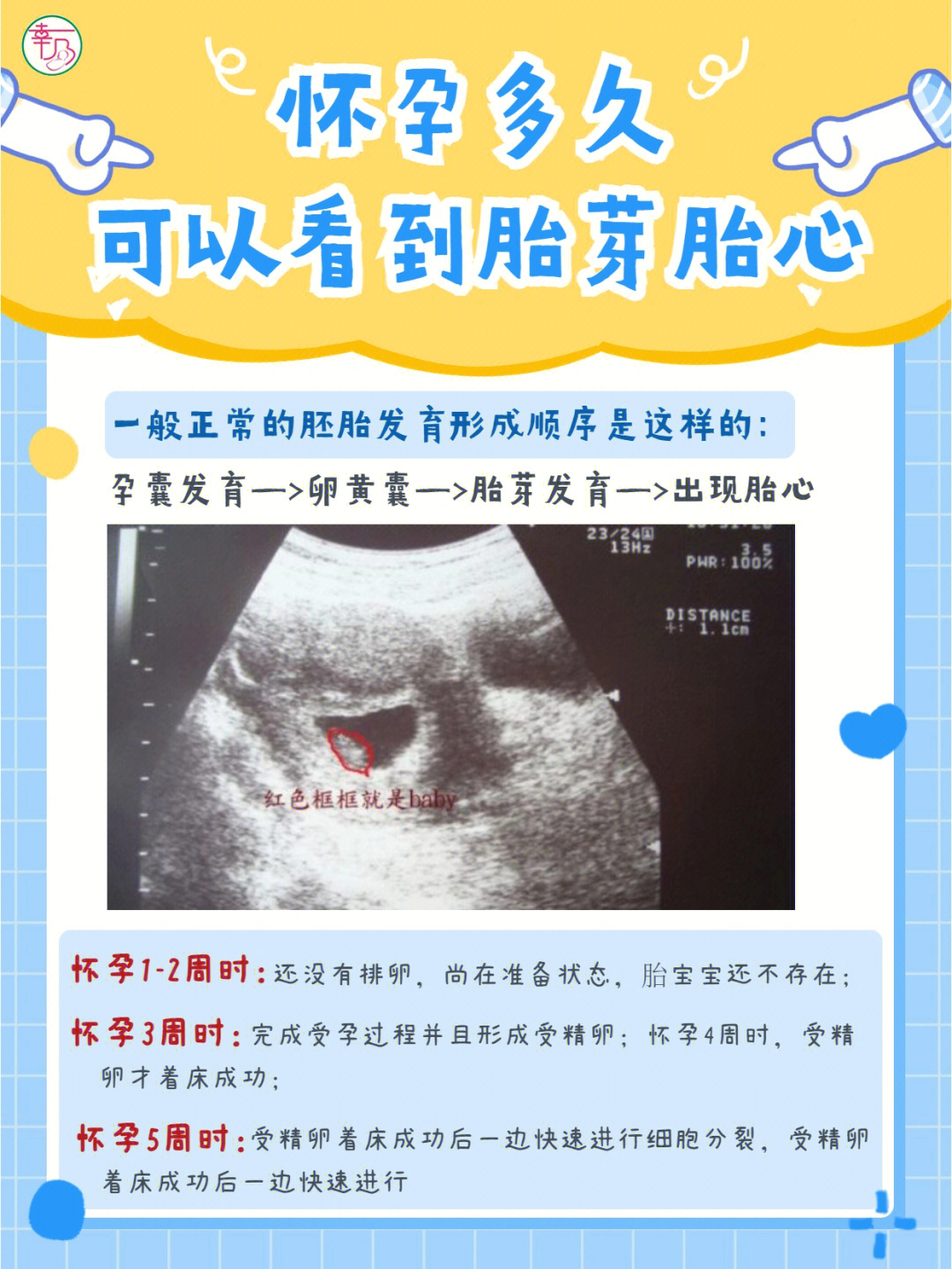 96一般正常的胚胎发育形成顺序是这样的:孕囊发育—