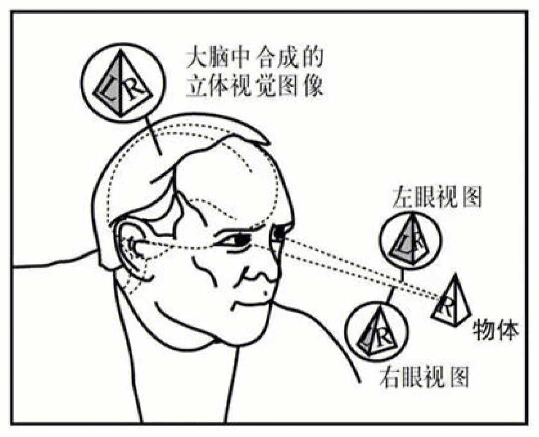 斜视手术图解图片