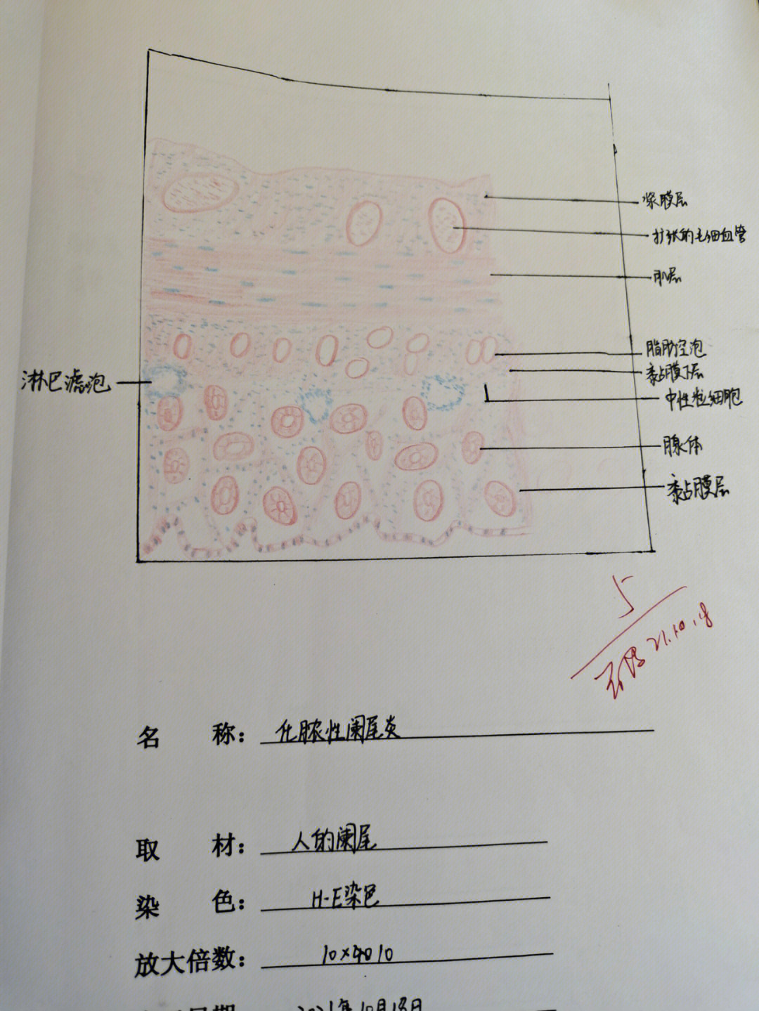 淋巴结光镜手绘图片