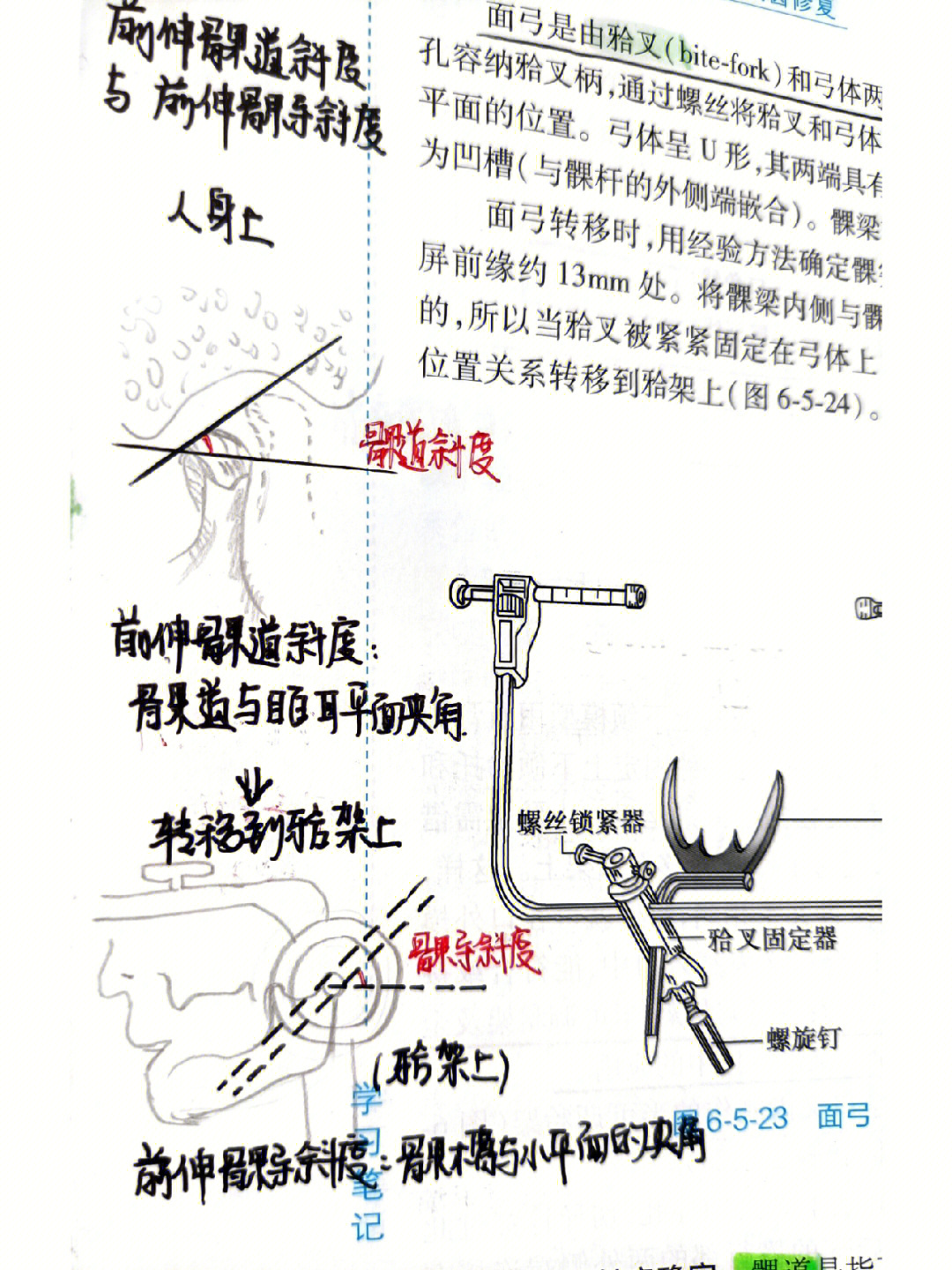 终于明白髁导斜度切道斜度了