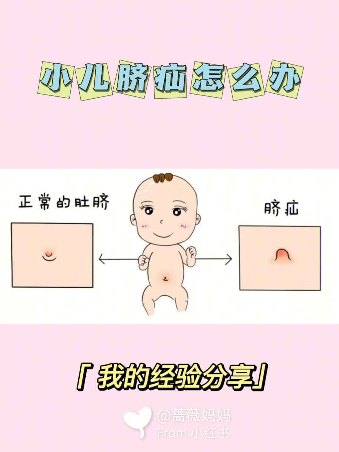 宝宝脐疝图片 症状图片