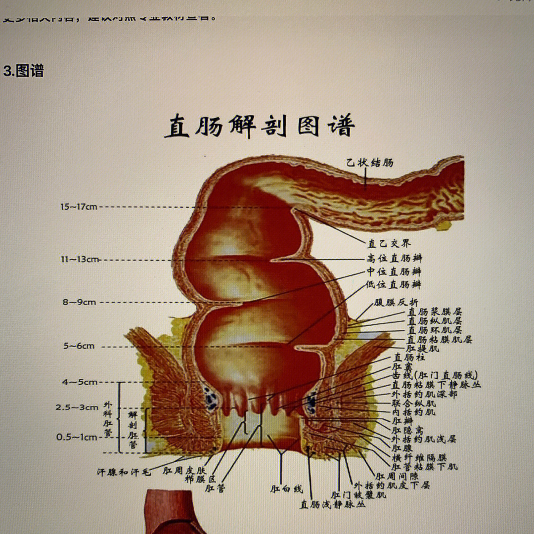 乙状结肠位置经常隐痛图片