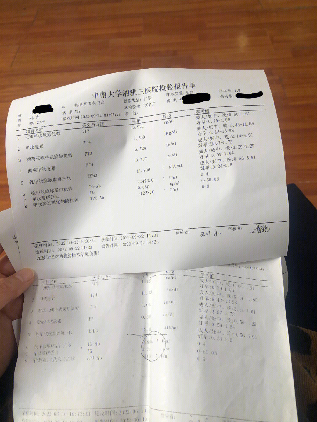 桥本77亚临床甲减