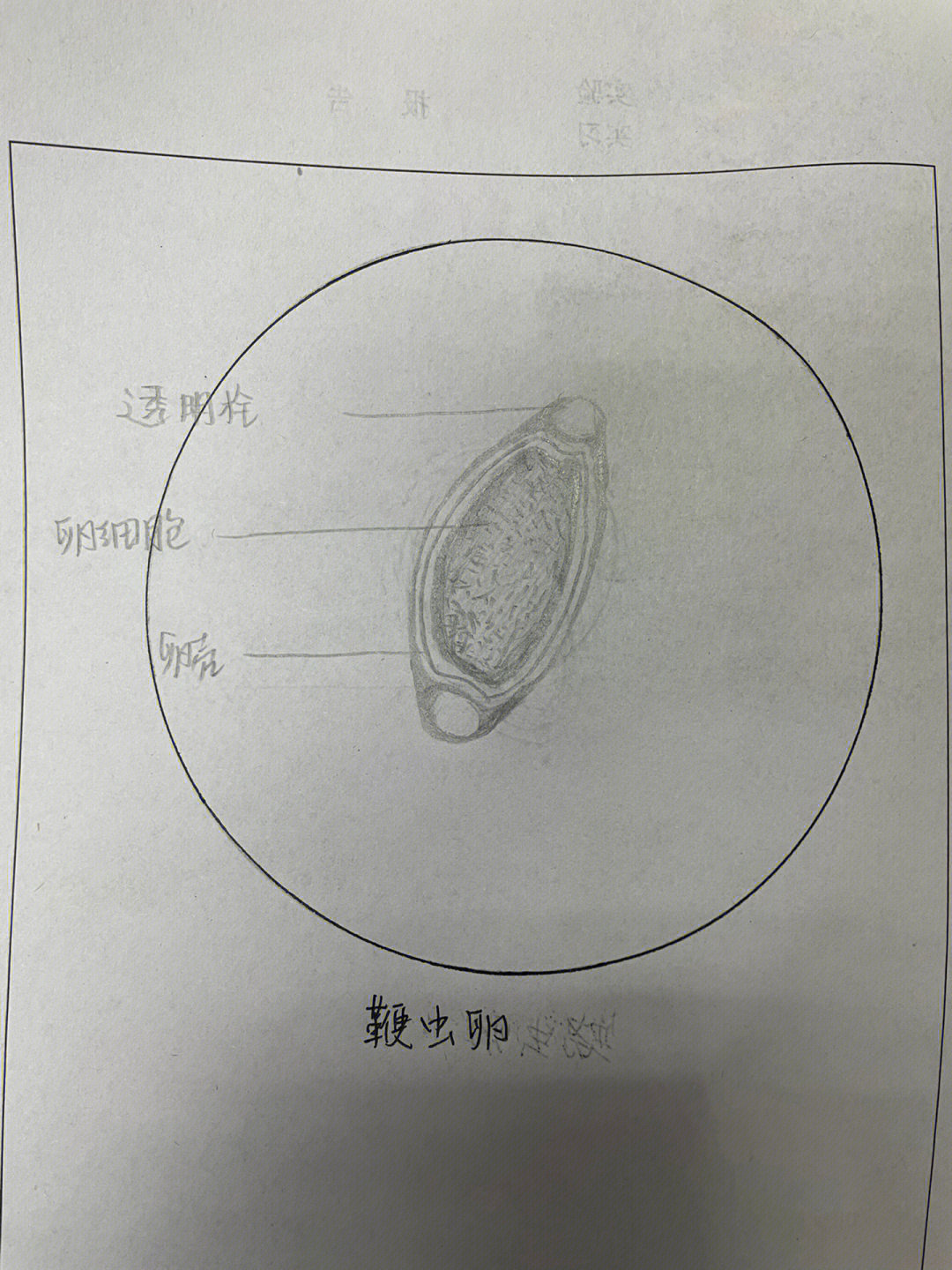 旋毛虫囊包手绘图片