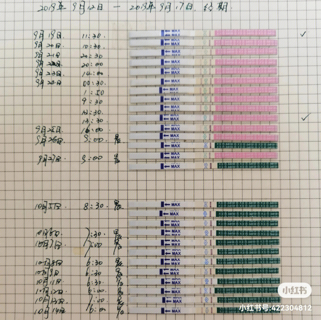 孕前检查染色体图片