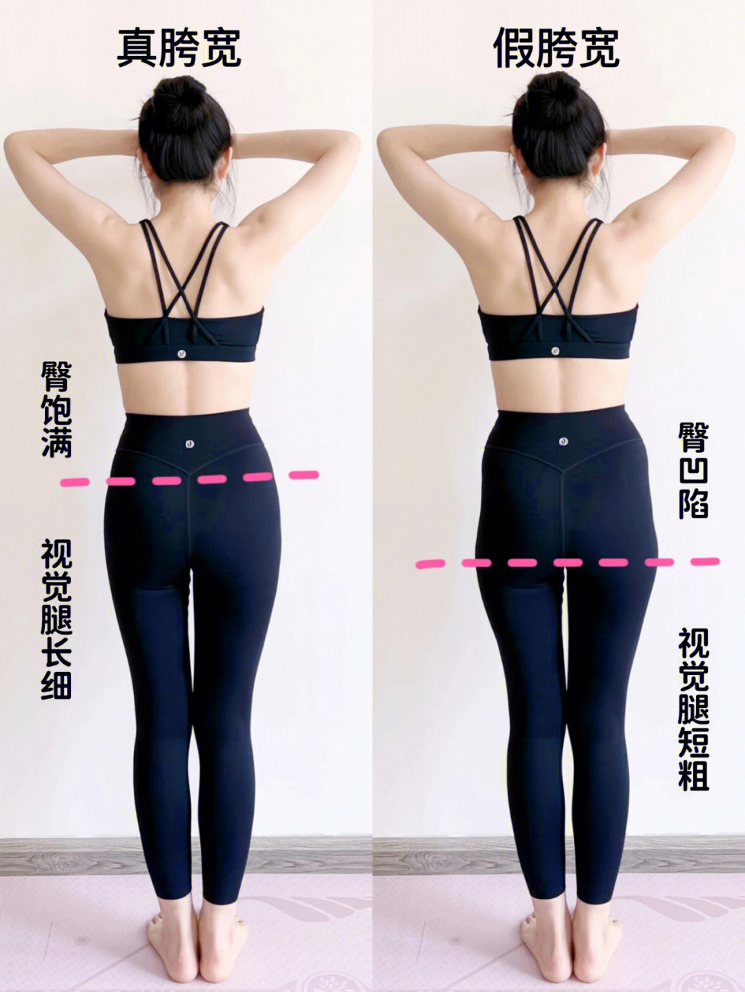 假胯宽一般都伴随着臀部两侧凹陷无力,侧腰赘肉,大腿根部外凸,不仅