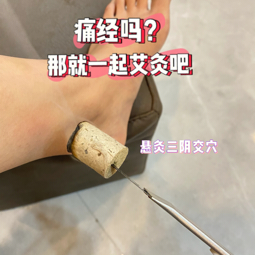 痛经人的懒鬼艾灸法