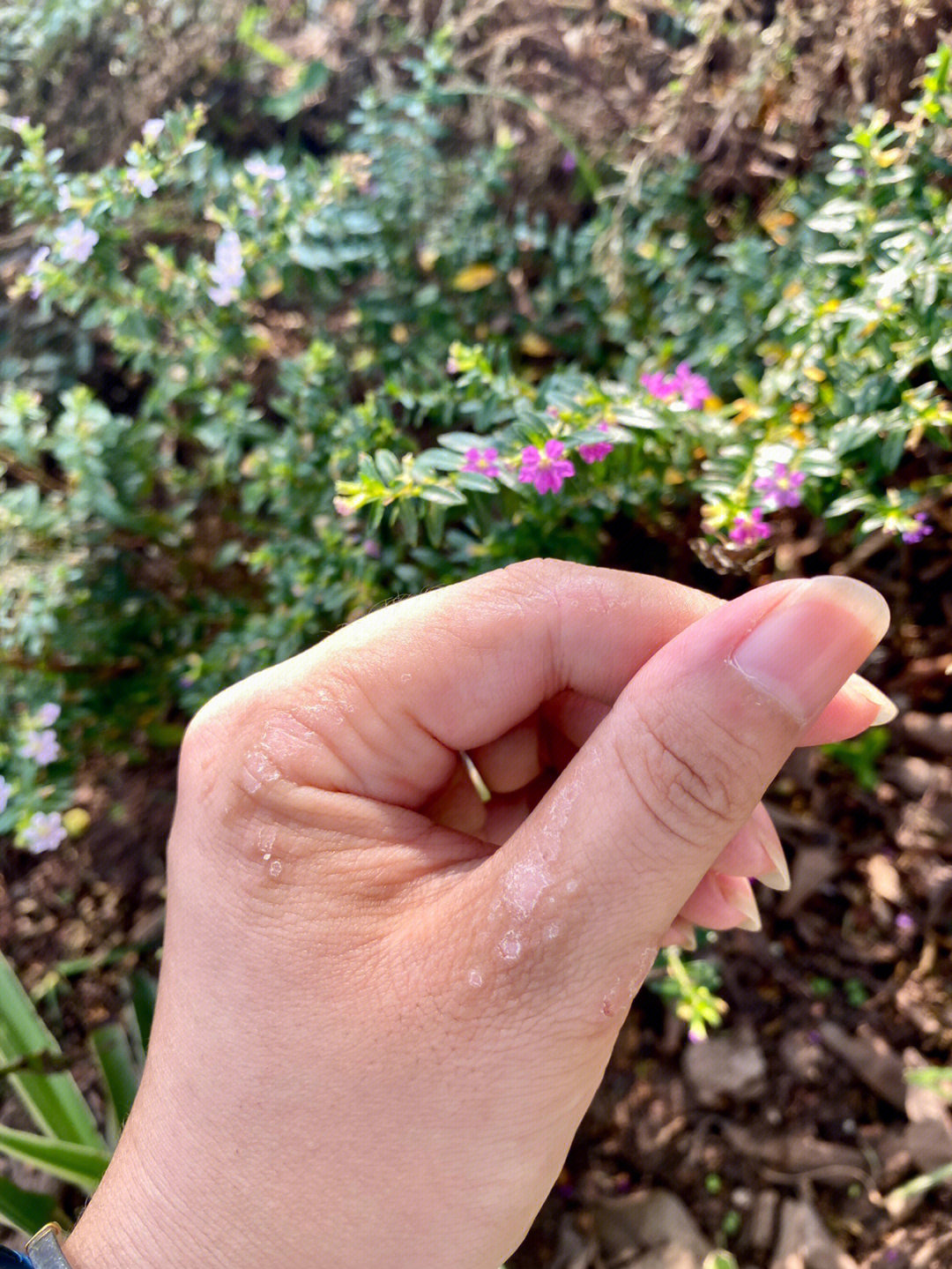 新华医院粉色湿疹膏图片