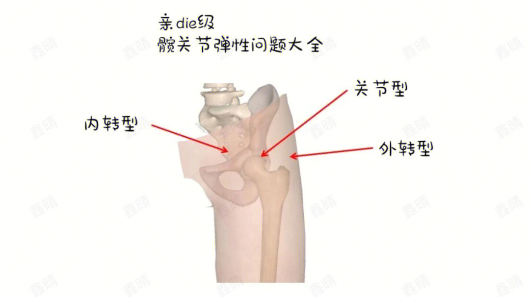 问题来源通常是髂胫束/臀大肌/阔筋膜张肌肌腱紧绷,滑过股骨大转子