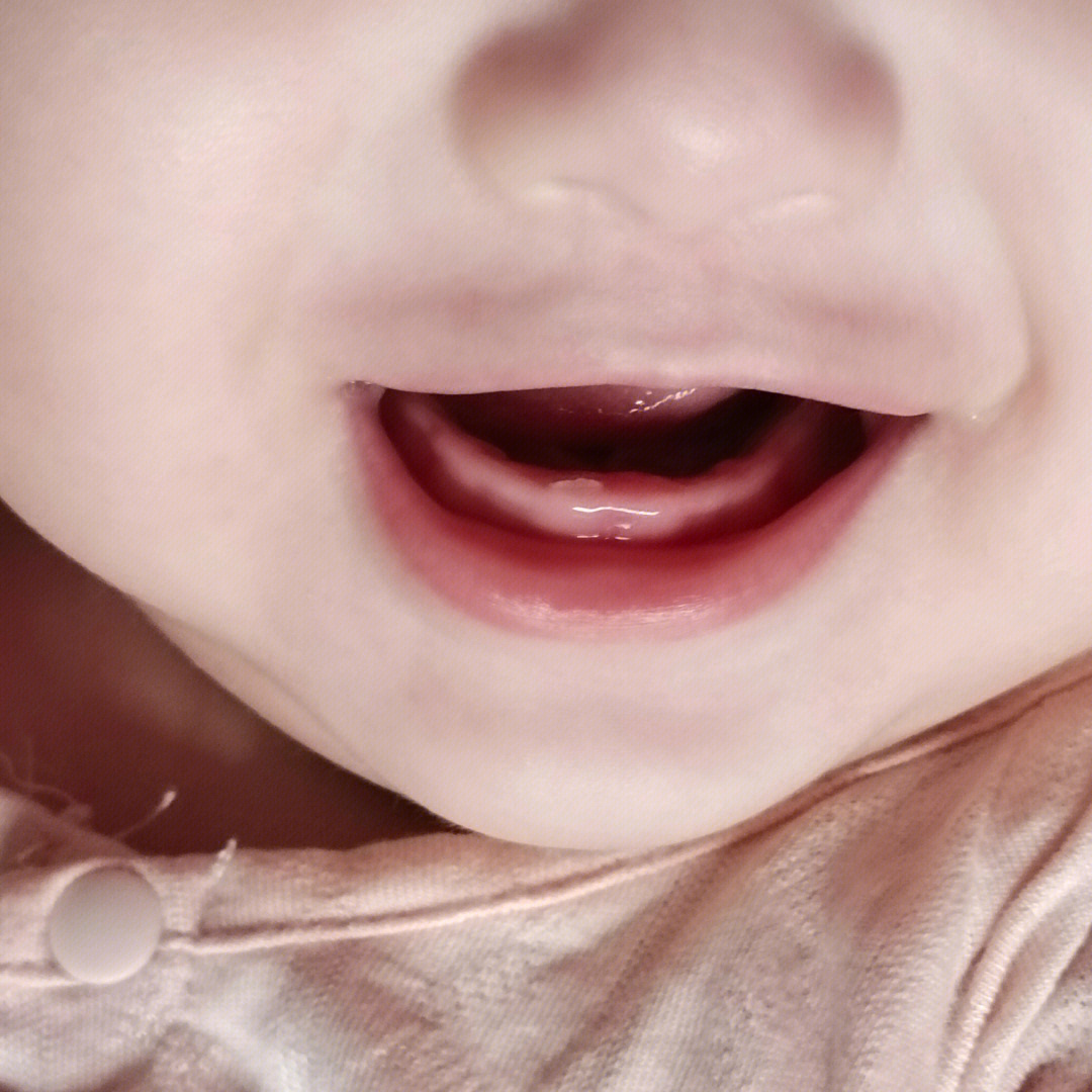 婴儿开始长牙齿的图片图片