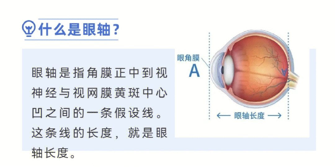 儿童眼轴测量事关少儿近视防控