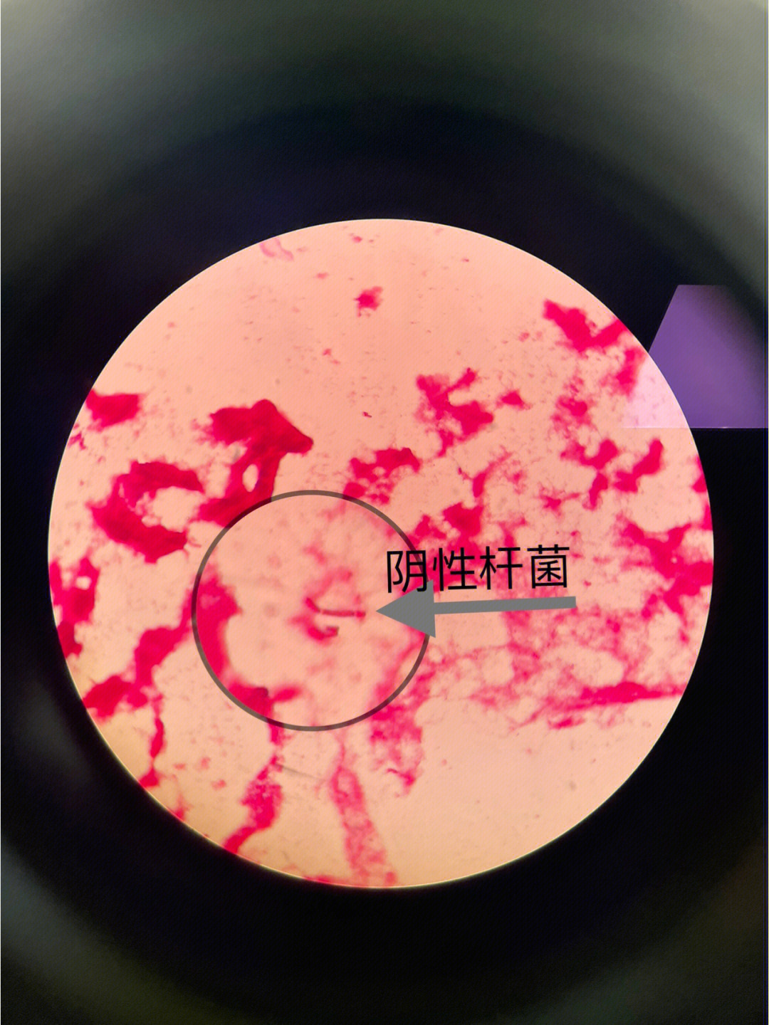 伤寒杆菌油镜图片