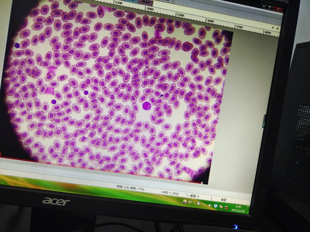 鸡血细胞   鸡血涂片显微镜观察