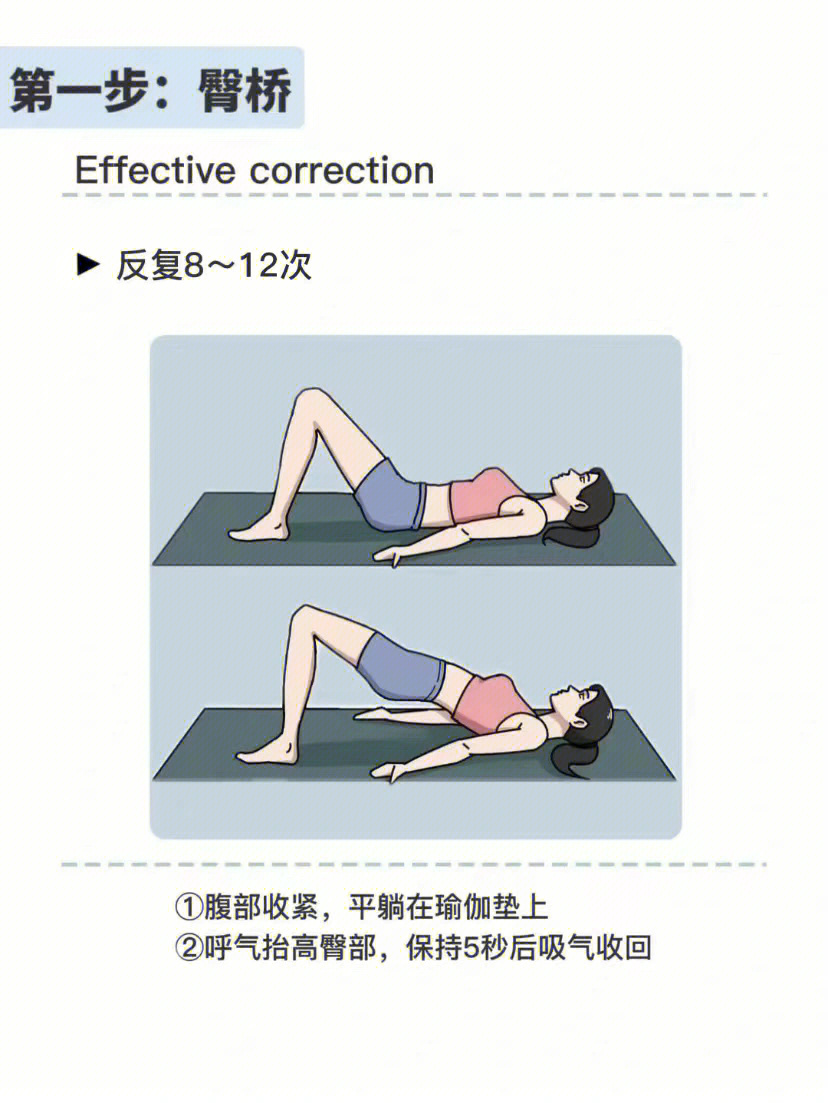 怎样纠正骨盆前倾图解图片