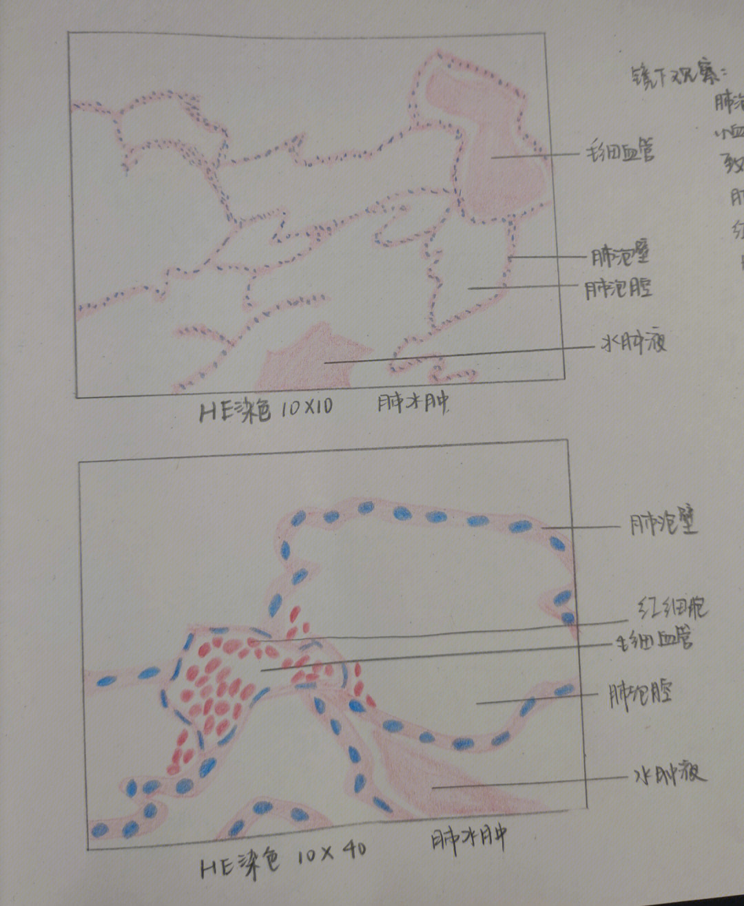 牙纵断磨片手绘图图片