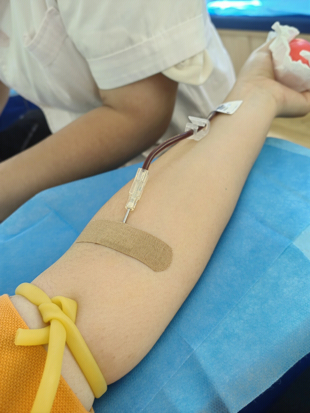 献血时的针管大小图片图片