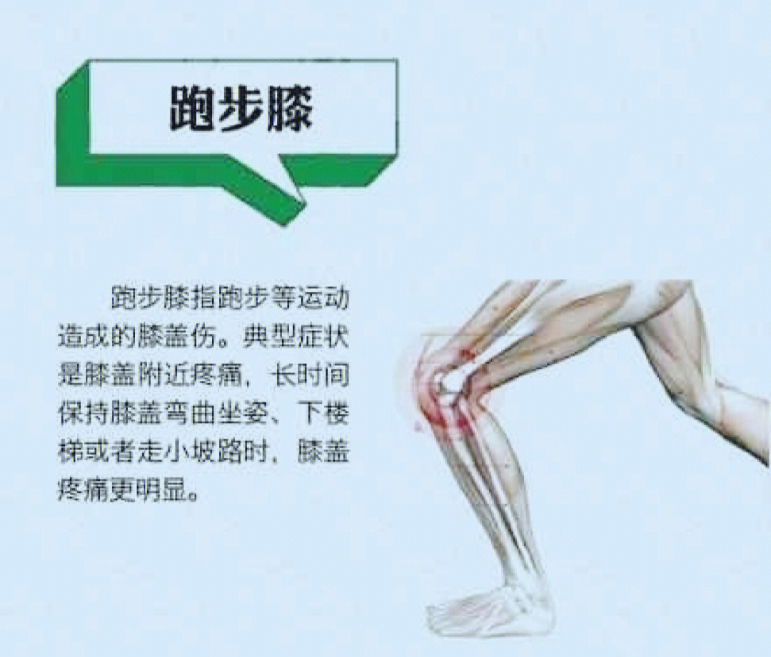 胫前疼痛,跟腱炎,足底筋膜炎,这些名称你可能不熟悉,但跑步后膝盖疼