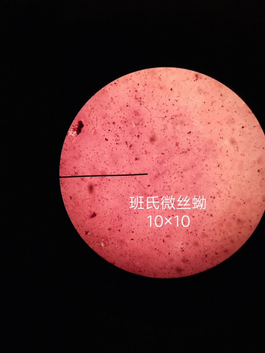 微丝蚴显微镜的图片图片