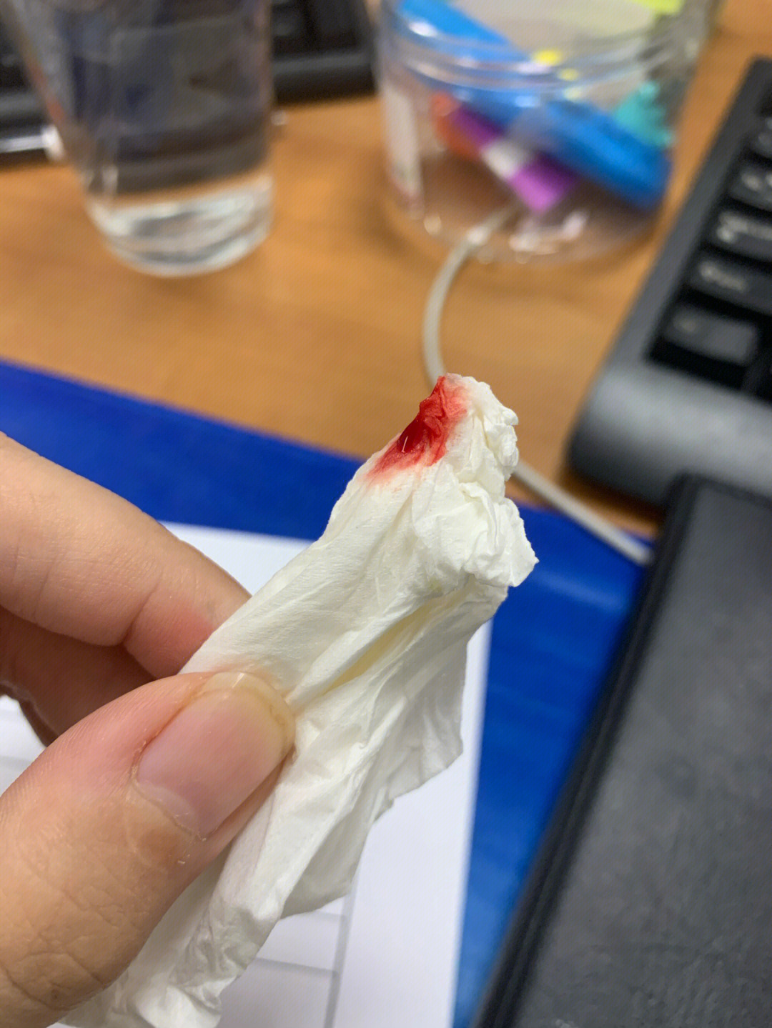 血纸巾照片流鼻血图片