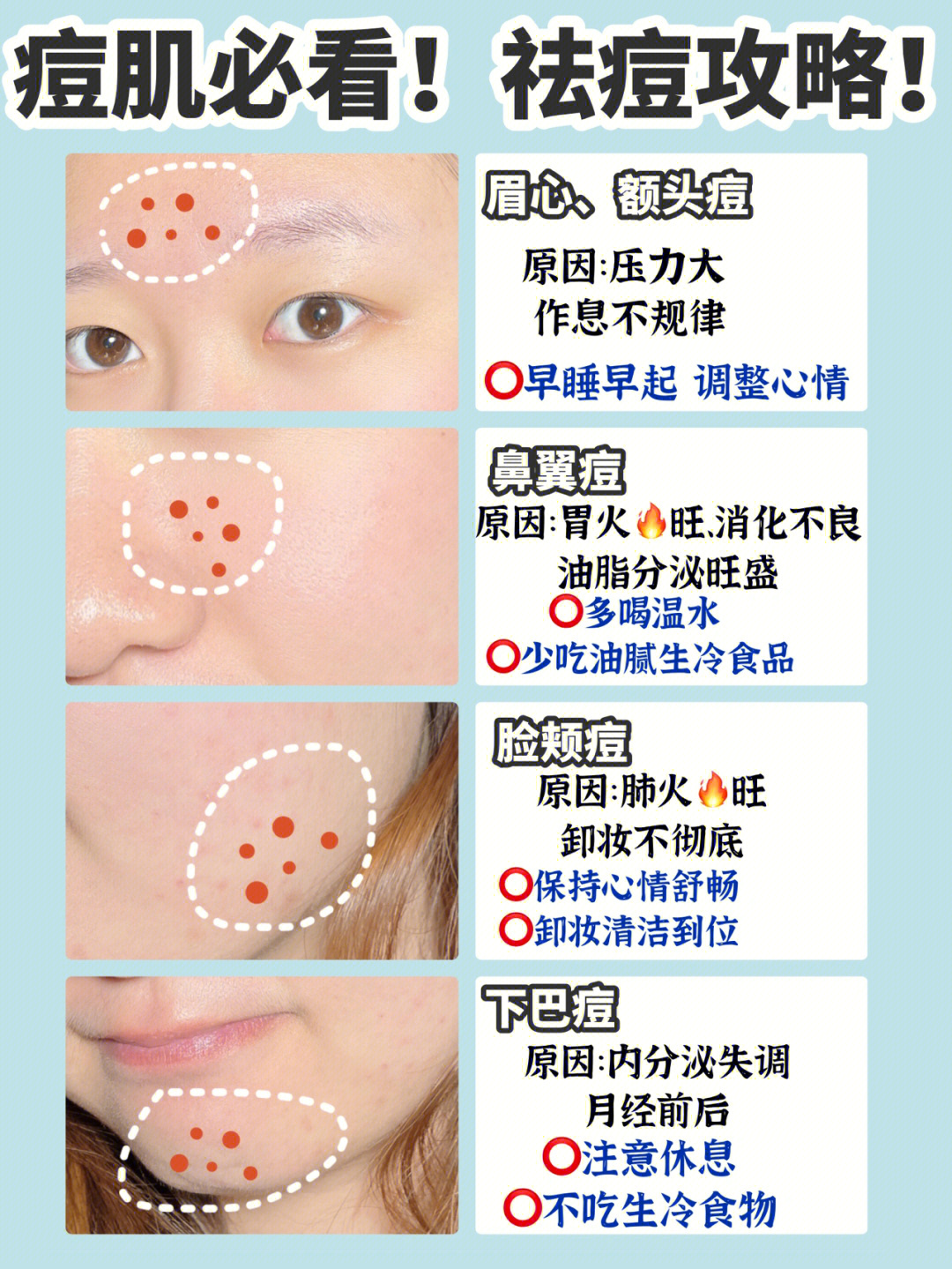 秋冬必戴口罩,防风保暖,当然脸颊也狠容易闷痘再加上每个月大姨妈到访