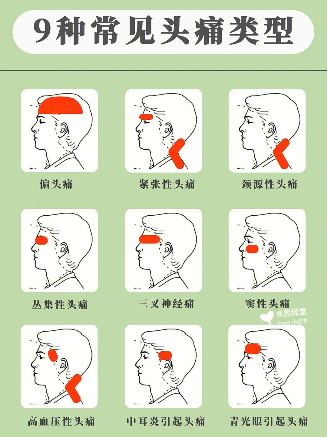 头疼位置图片