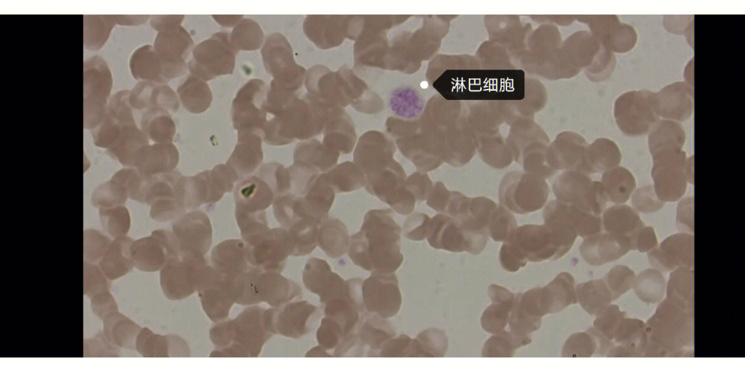 疟原虫红内期镜下