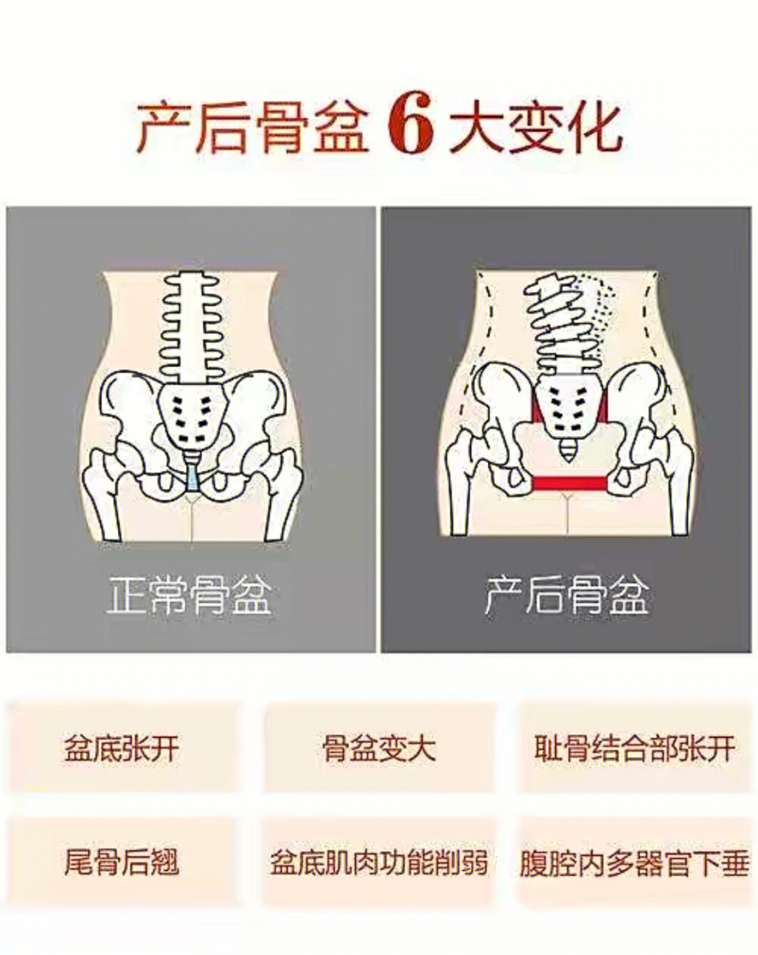 生过孩子的胯骨图片图片