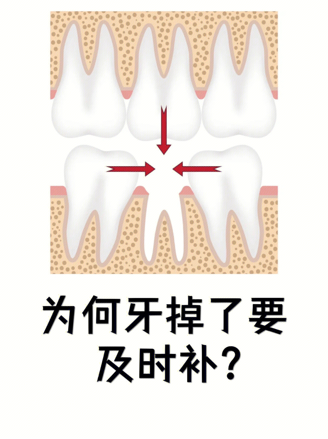 为什么会掉牙图片