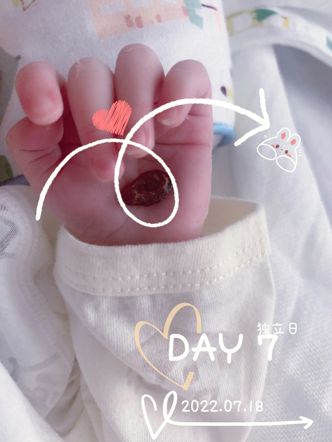 新生儿脐带脱落过程图图片
