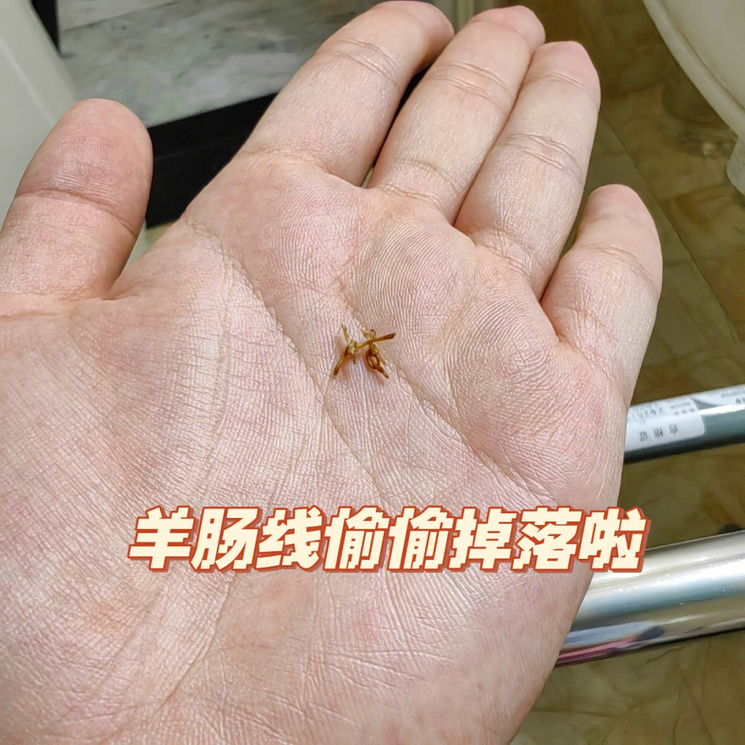 顺产羊肠线不吸收图片图片