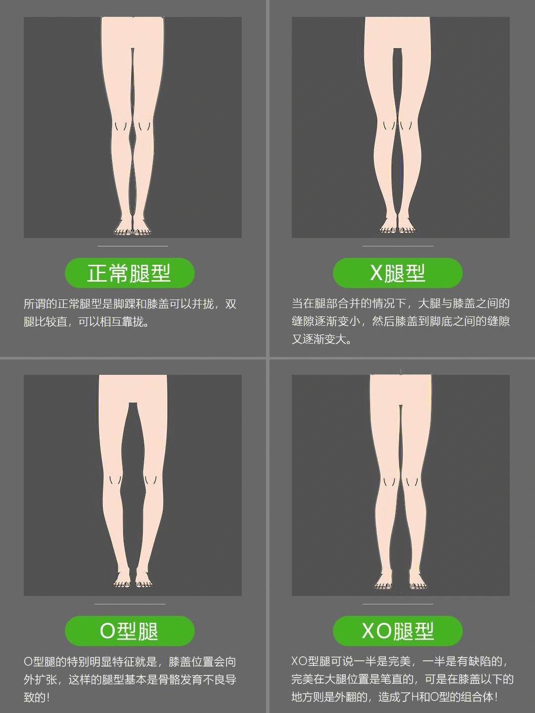 正常腿型是什么样子的图片