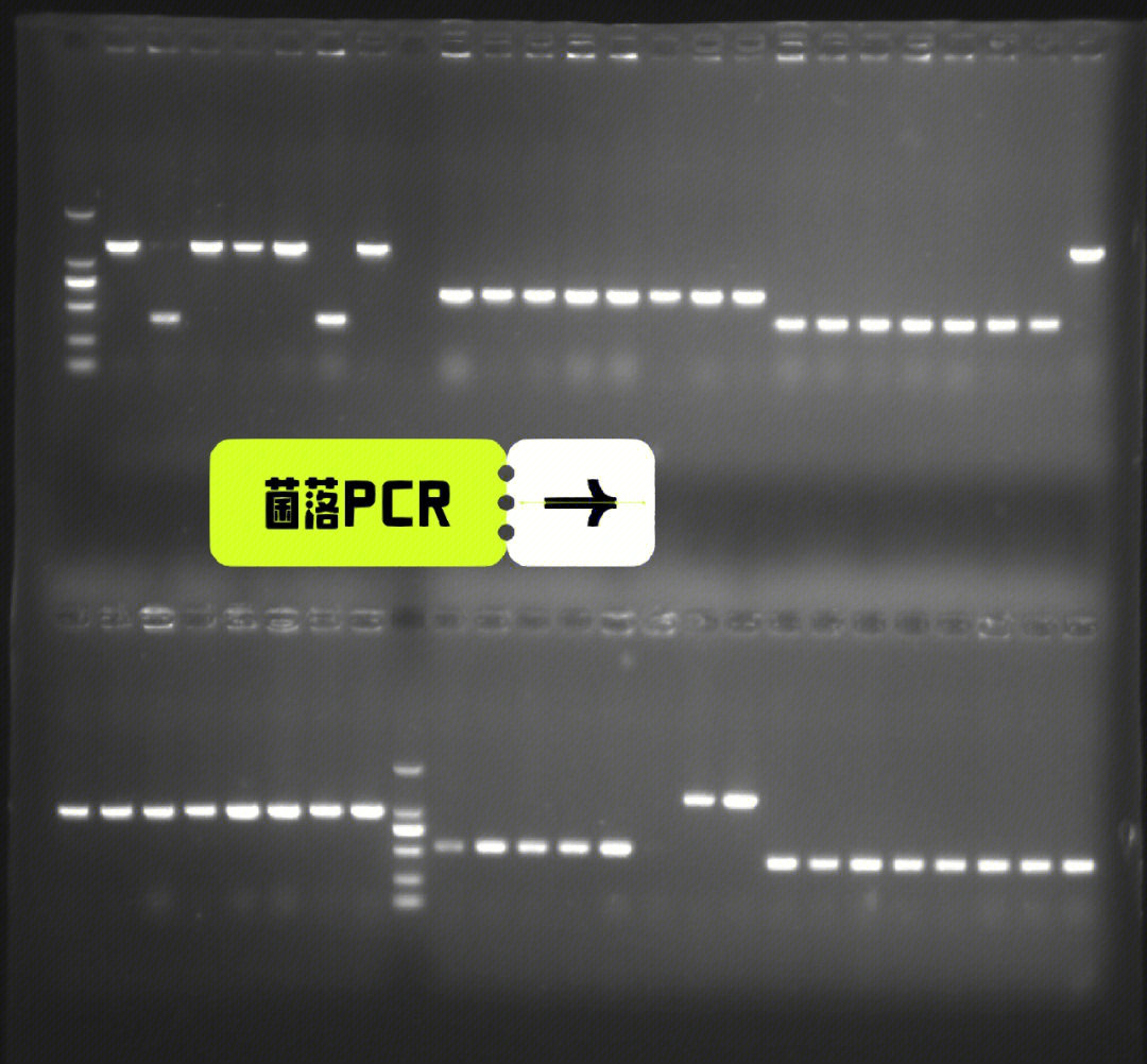 菌落pcr引物设计与实验流程