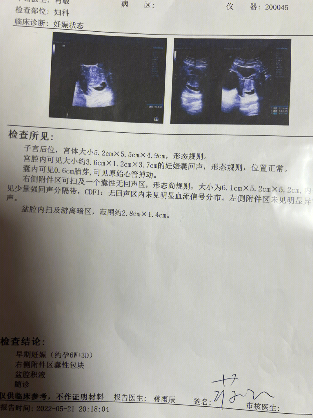 宫腔积血图片图片