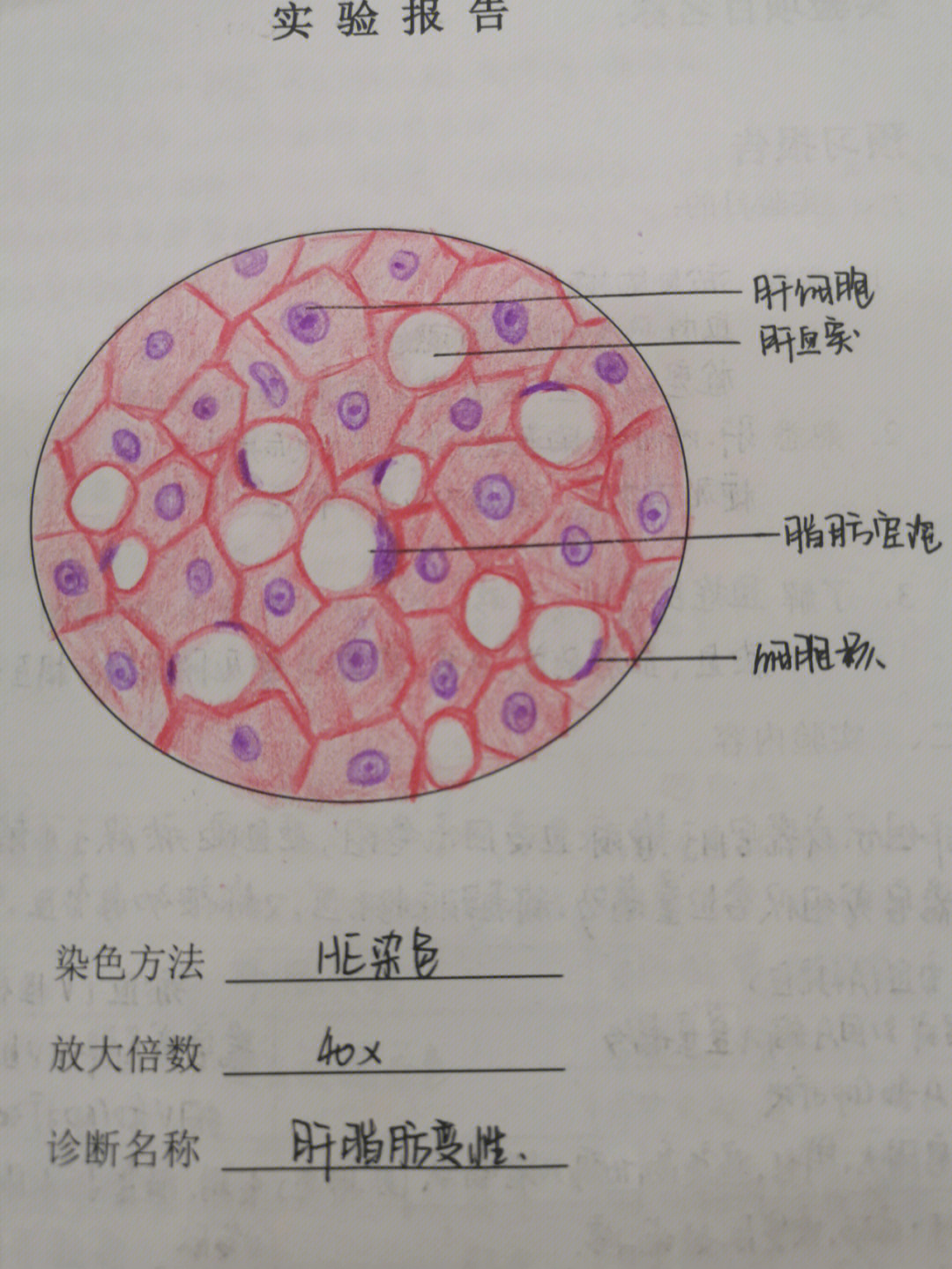 弧菌红蓝铅笔绘图图片