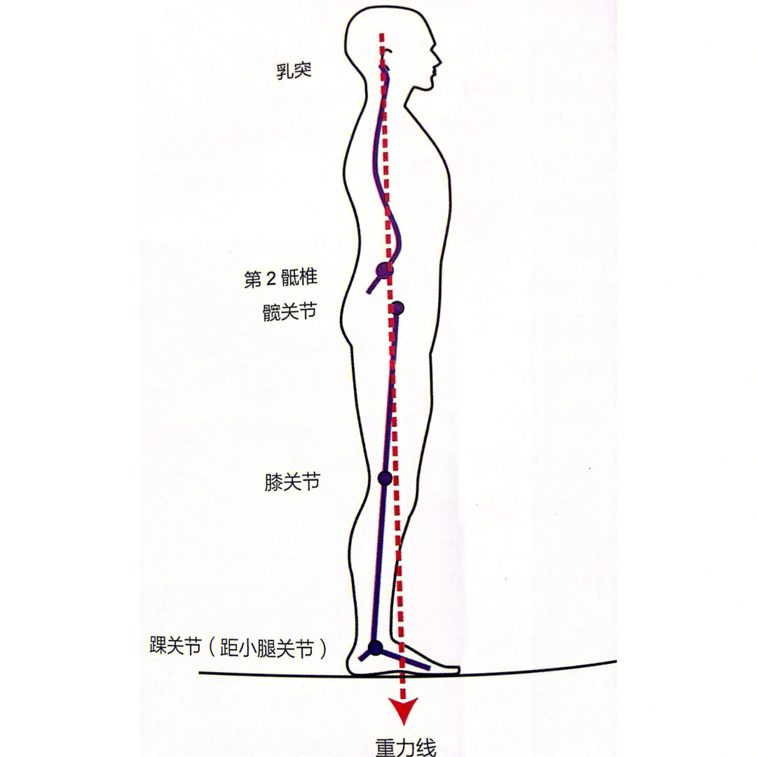 各种不良站姿图图片