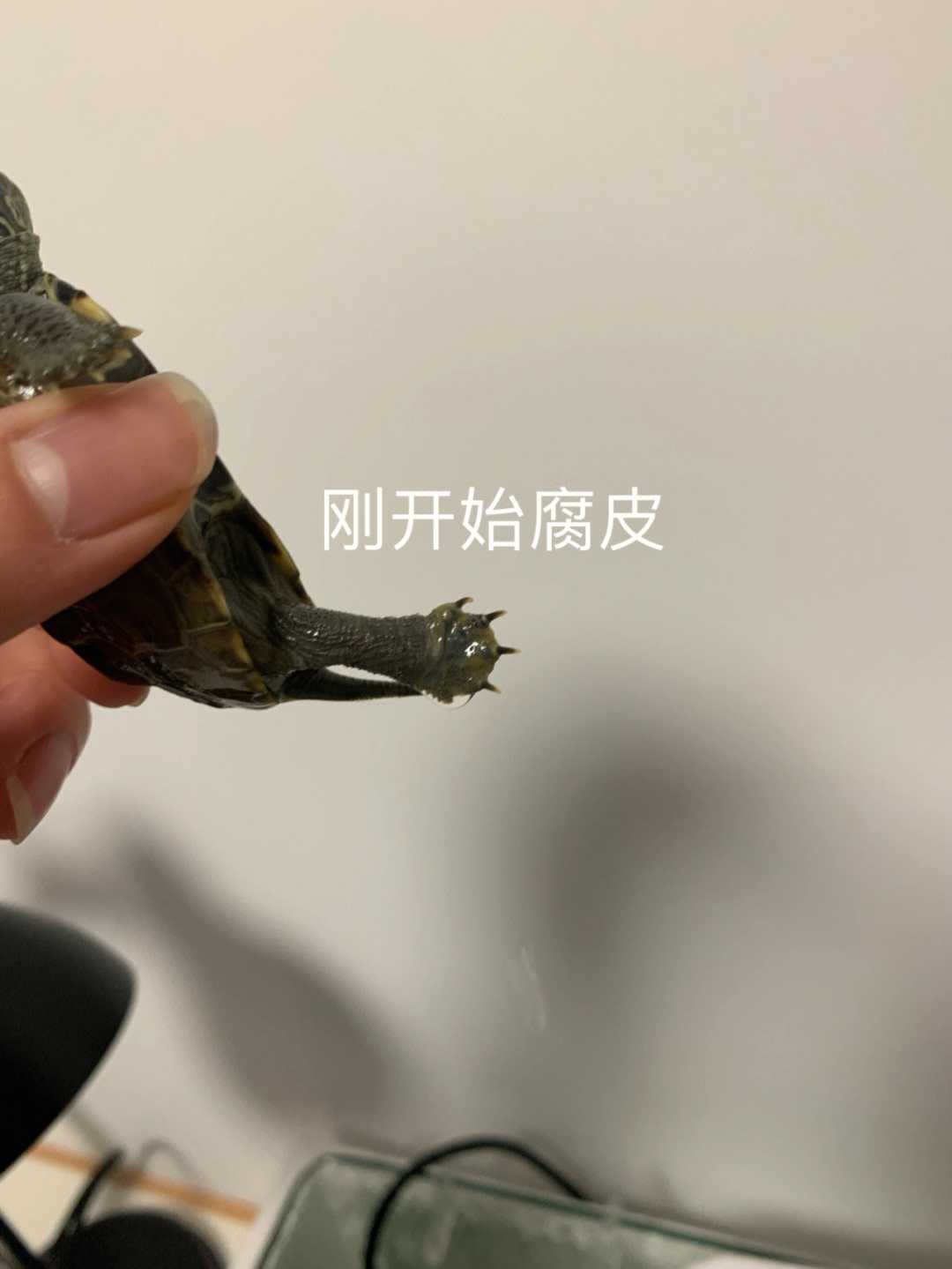 龟龟腐皮治疗