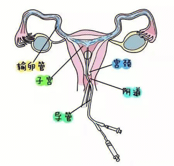 输卵管位置腹部图片