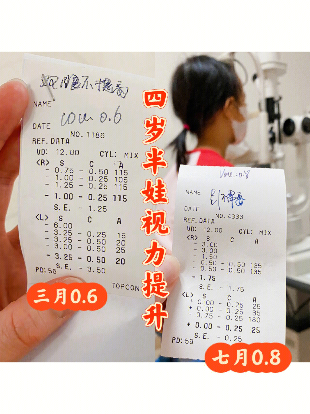 4岁4个月视力0.6提升到0.8(附检查单解读)