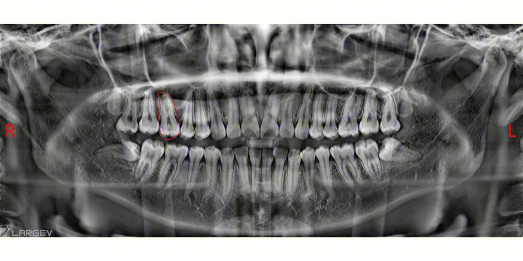 牙齿ct图片怎么看得懂图片