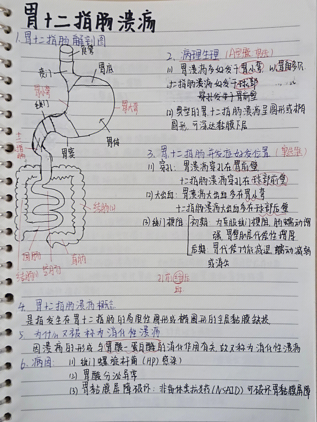 整个胃点胃溃疡手绘图图片