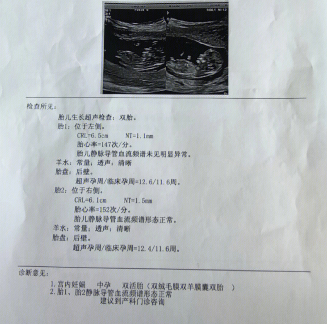 12周胎心位置示意图图片