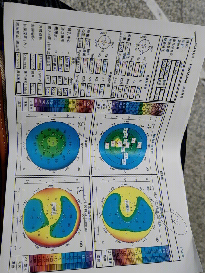 角膜地形图检查的目的图片