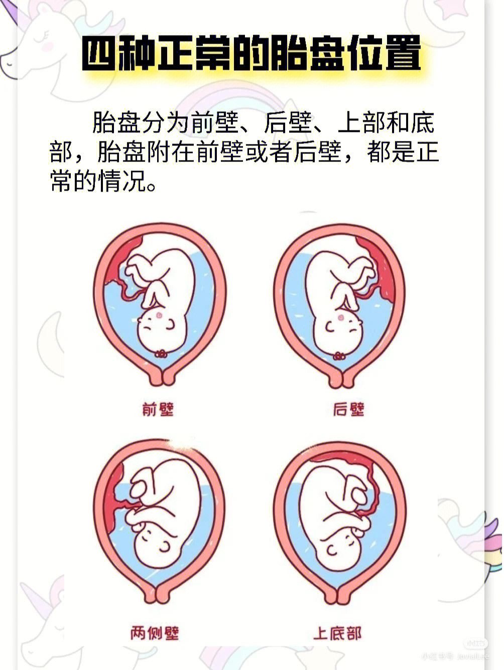 各种胎盘位置图 前壁图片