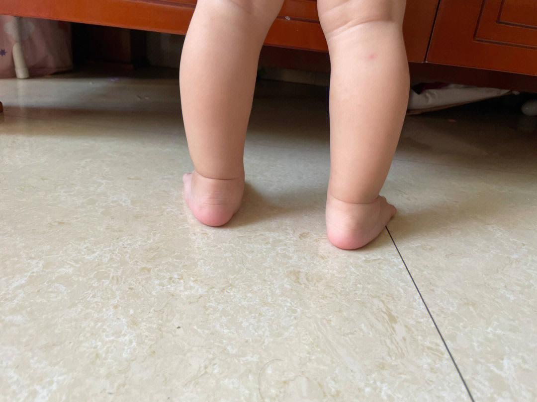 2个月婴儿腿型图图片