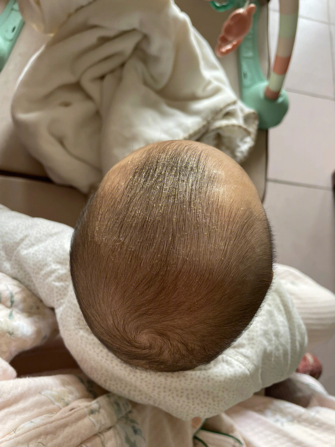 三个月发现宝宝头型上扁,枕骨凸出,就开始想各种办法睡,然后就是没