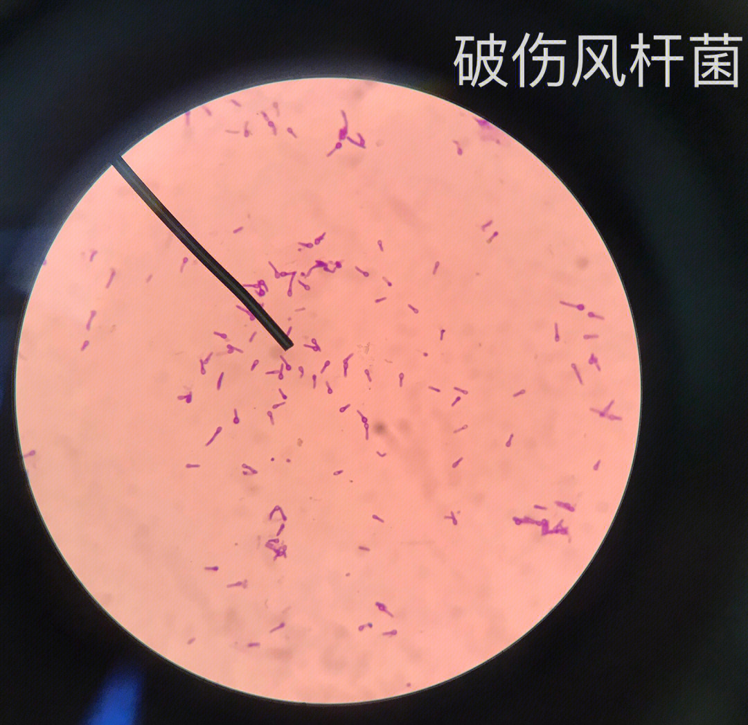 一个普通的医学生日常看细菌切片