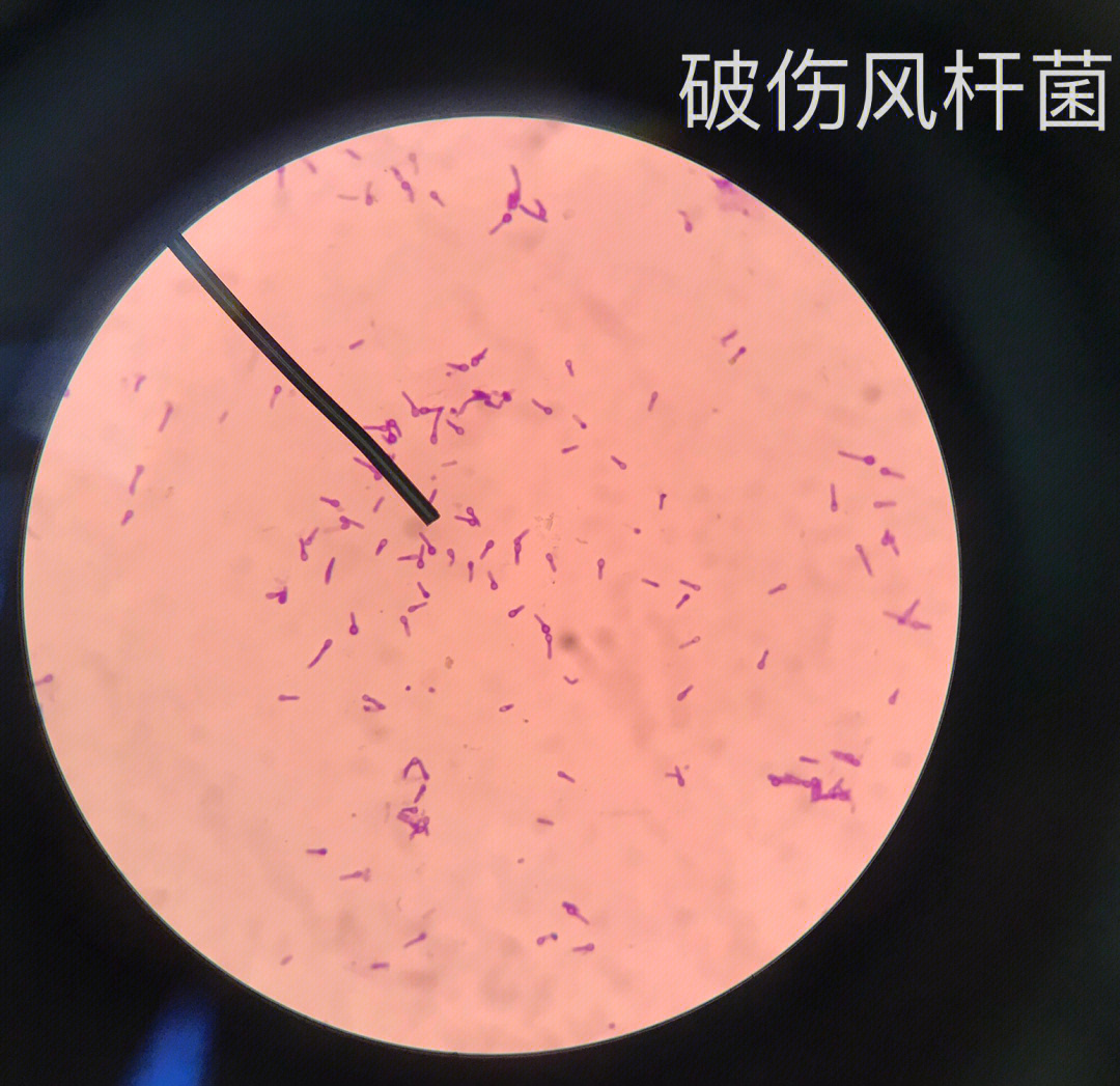 伤寒杆菌显微镜下图片图片