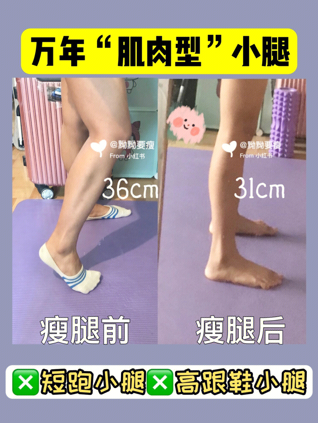 短跑型肌肉小腿都瘦了5cm啦75瘦小腿合集