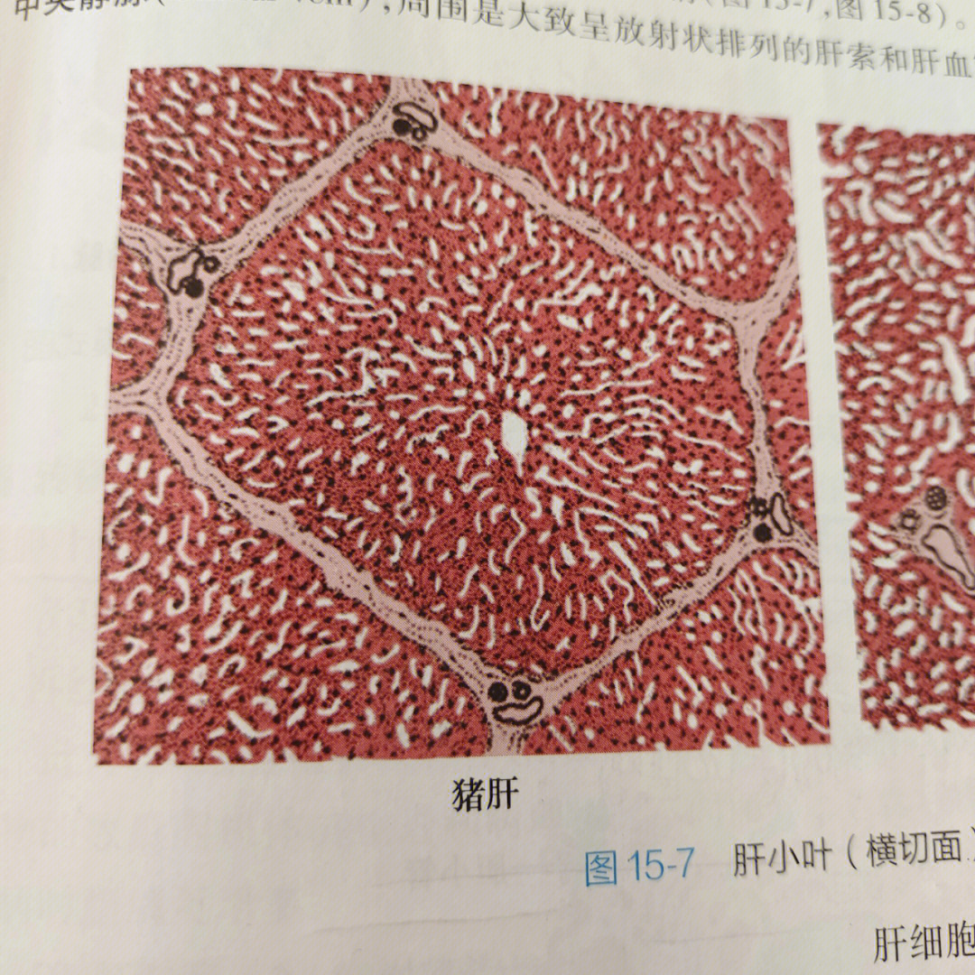 肝小叶的显微镜结构图图片